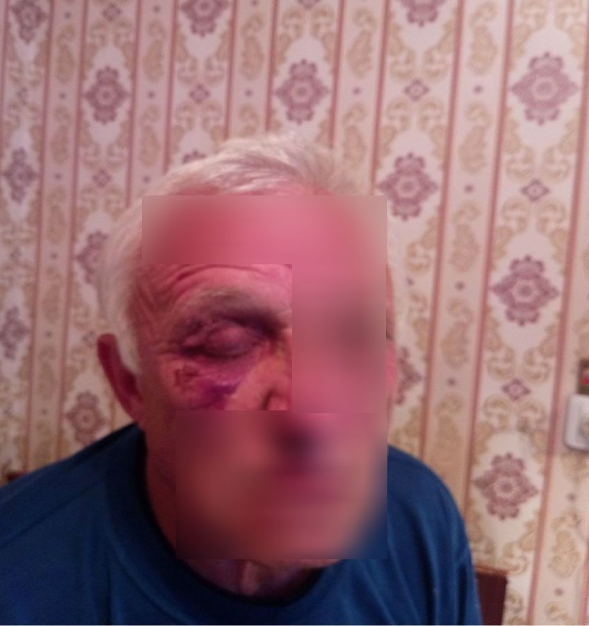 Полиция разыскивает избивших костромского дедушку ВДВшников