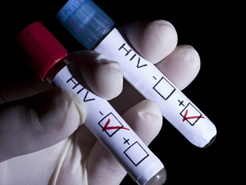 Десятки костромичей каждый месяц узнают о  своем заражении ВИЧ
