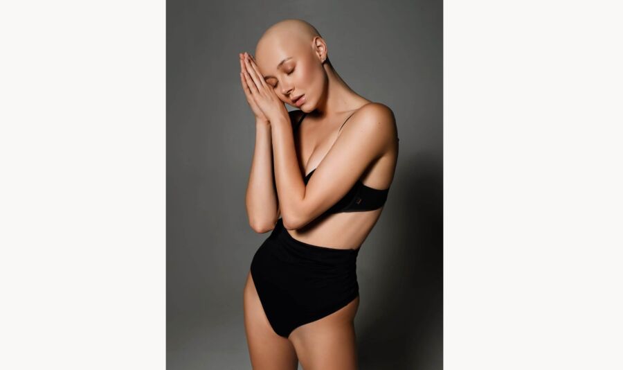 Костромская модель Светлана Хохлова откровенно рассказала о борьбе с онкологией