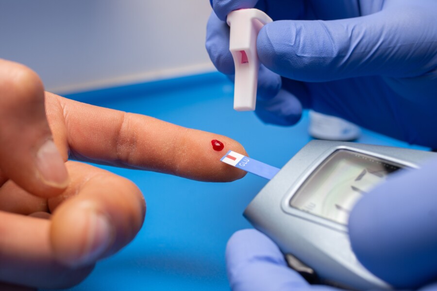 Костромские чиновники рассказали о выдаче бесплатных тест-полосок взрослым диабетикам