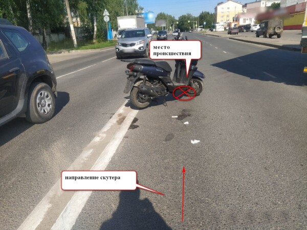 Костромич упал со скутера и оказался в больнице